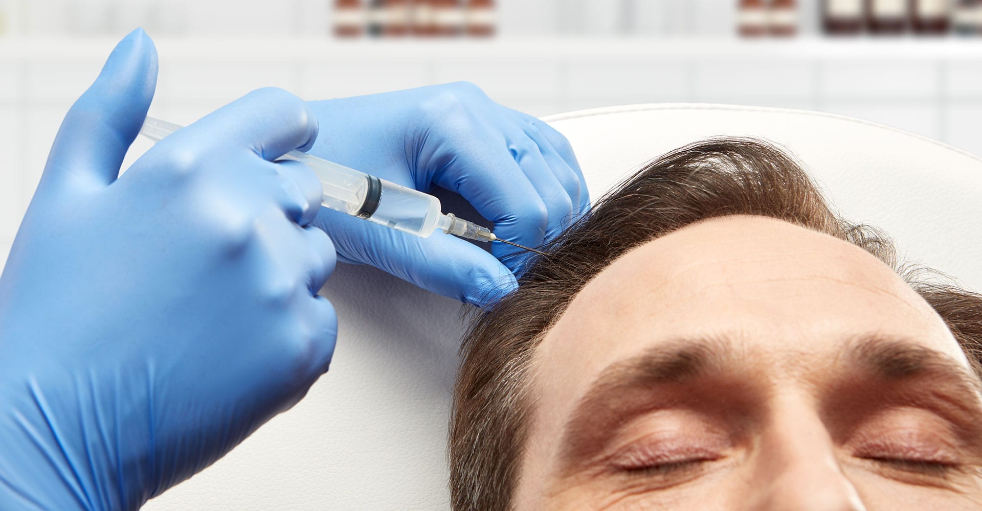 prp-treatment