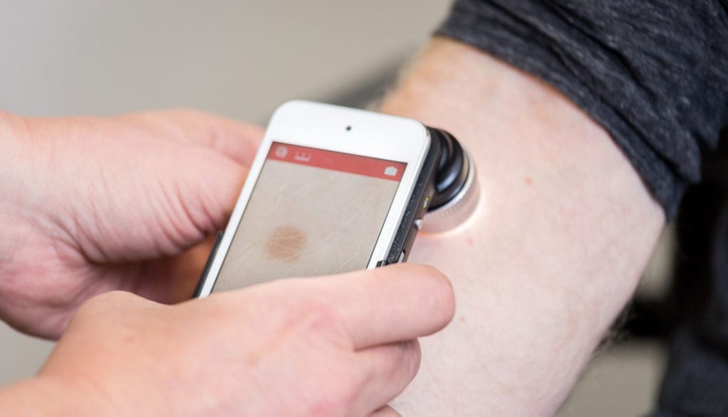 skin cancer awareness and prevention