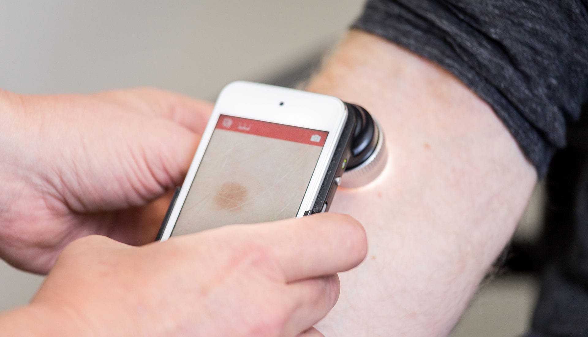skin cancer awareness and prevention