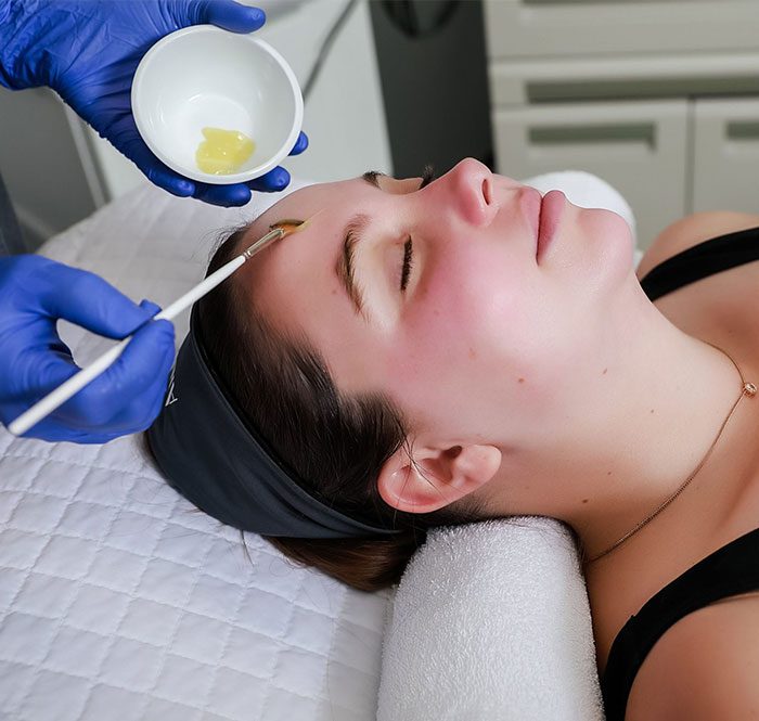 skin-rejuvenation-image2