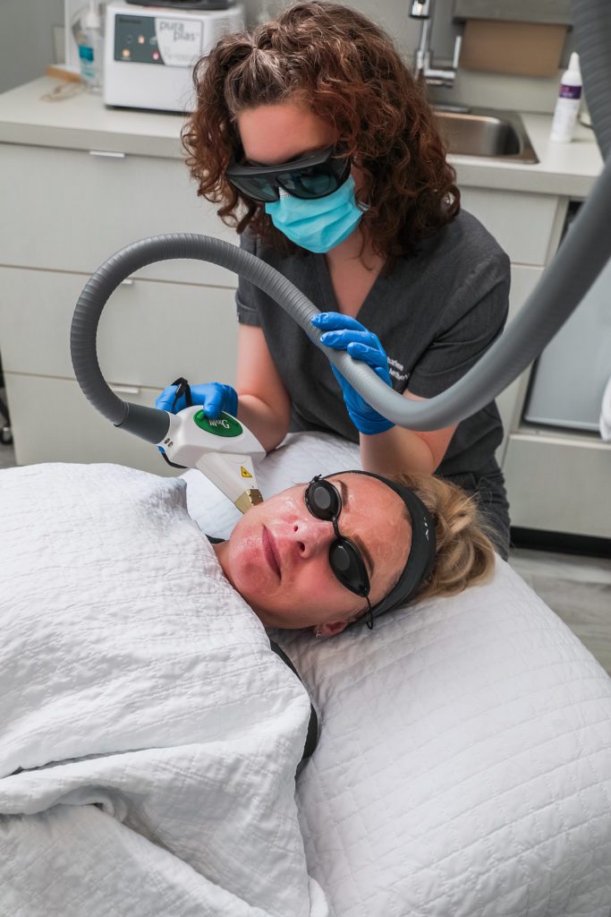 aesthetician performing IPL treatment