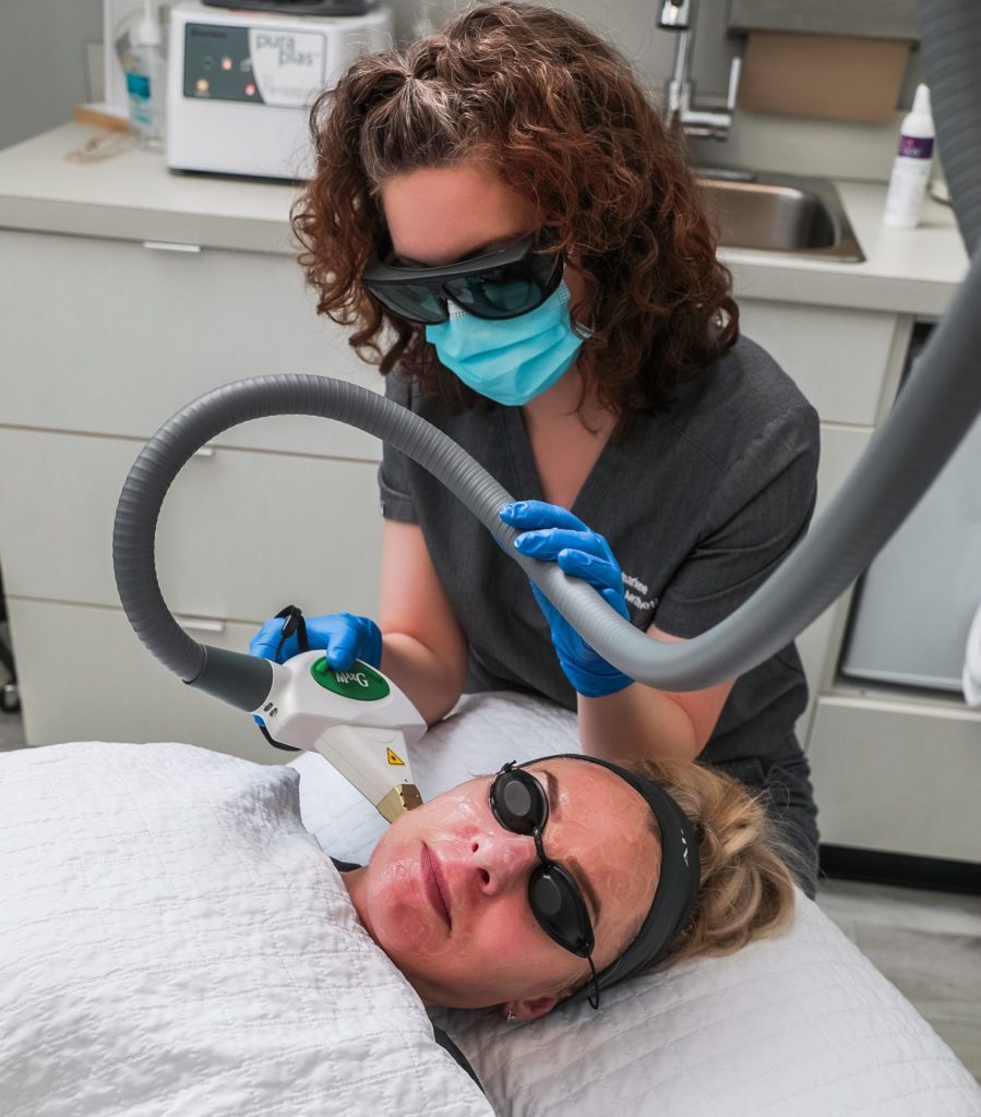IPL Facial