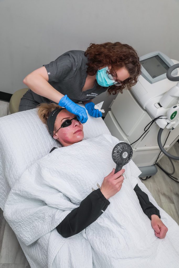 IPL treatment procedure