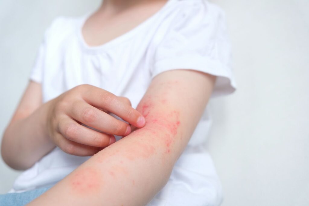 girl scratching her arm.