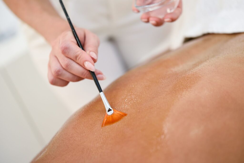 Aethetician applying a toner on a patient's back with a brush