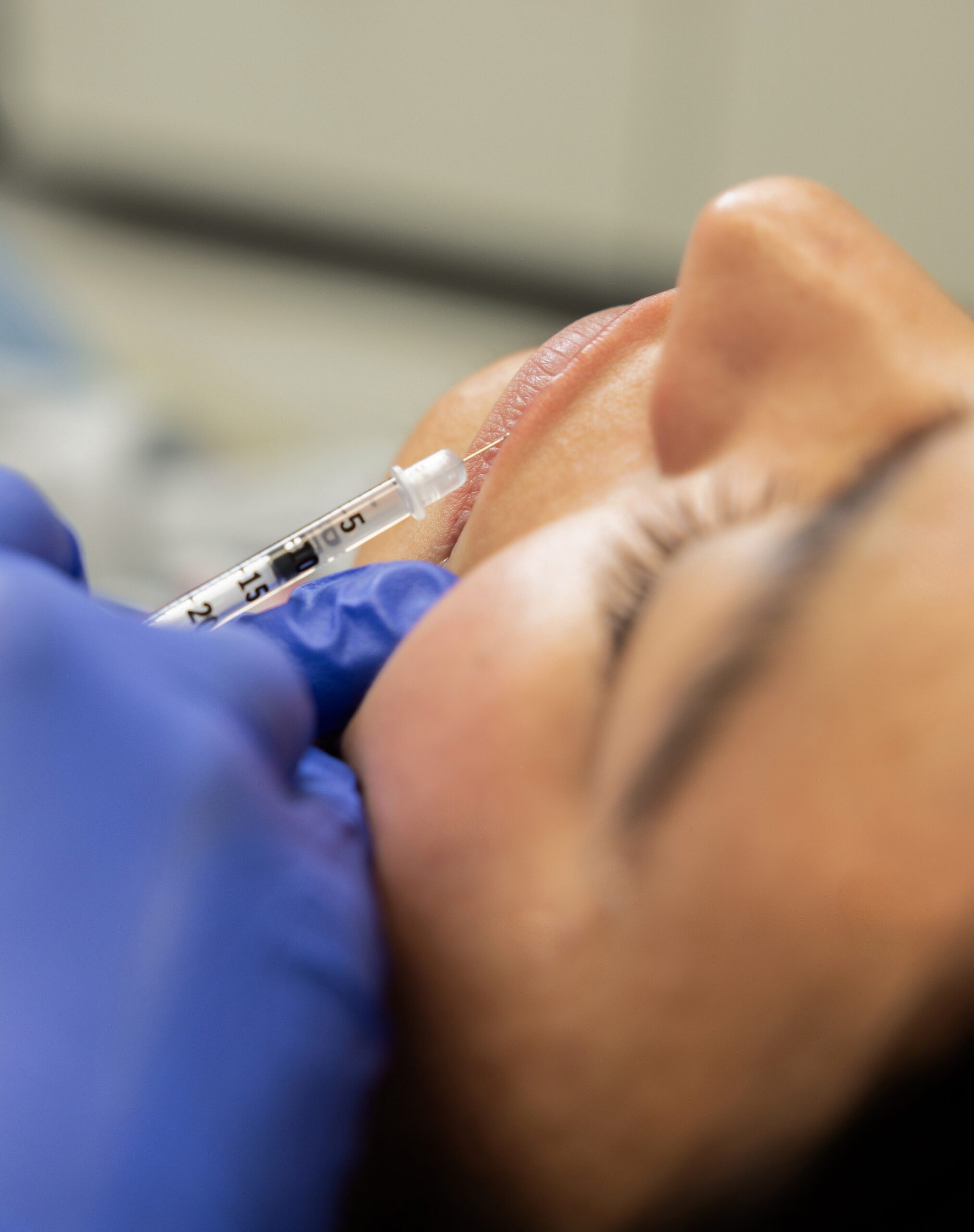 fillers-new