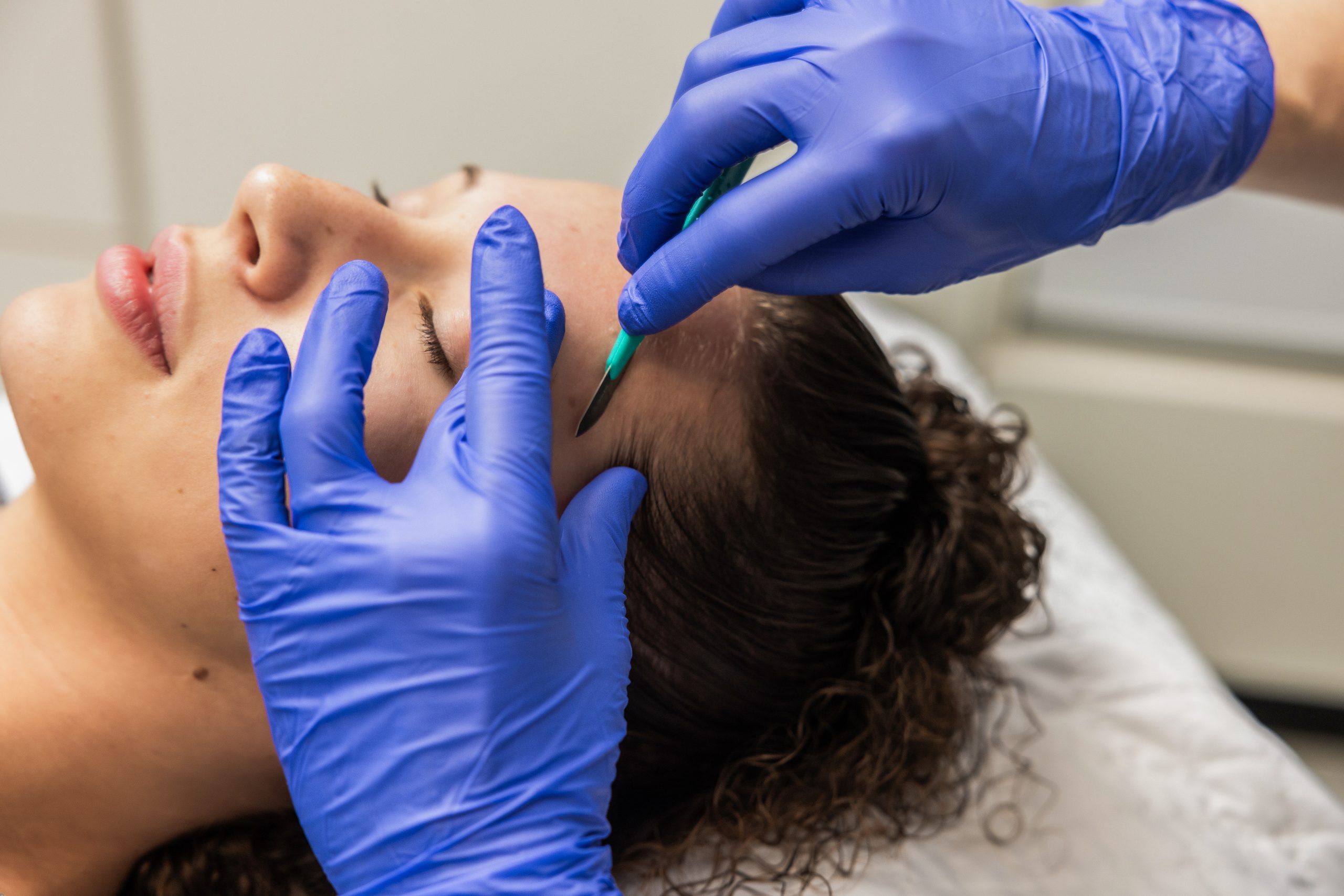 Dermaplaning 1